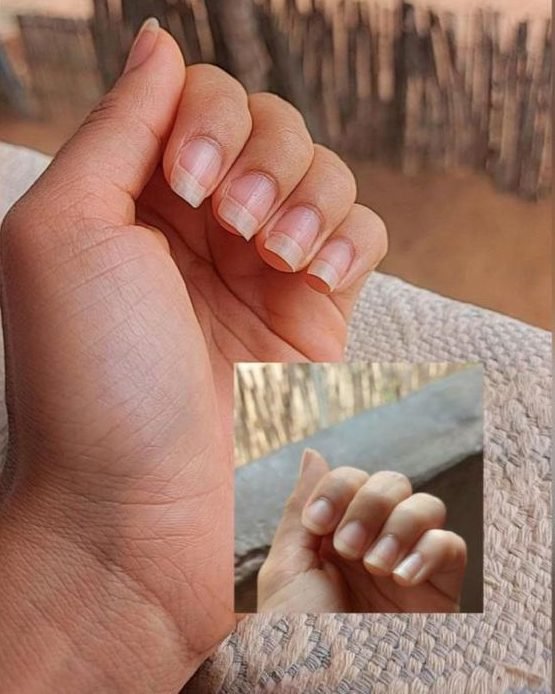 Mão de cliente mostrando as unhas
